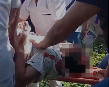 Un accidente en la Asamblea Legislativa de El Salvador dejó a tres empleados del Ministerio de Trabajo con lesiones graves tras la caída de un árbol. (Foto cortesía)