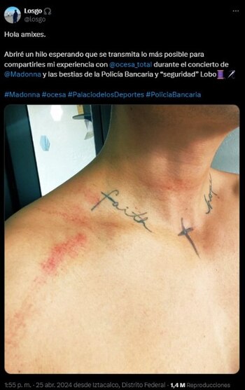 Fan de Madonna denuncia agresión