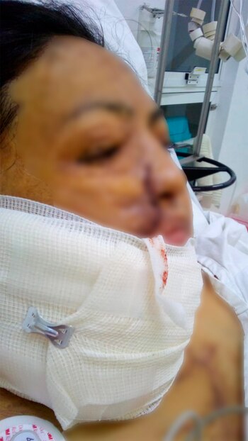 La víctima fue acompañada por