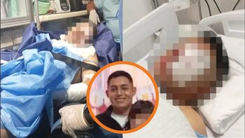 Policía sufrió quemaduras, lesiones y fracturas graves. Se encuentra ingresado en el Hospital del Policía. Composición Infobae/RPP