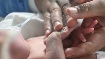 Un bebé prematuro extremo, nacido