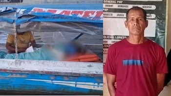 Intento de feminicidio en Iquitos: Mujer resulta con el 30 % de su cuerpo quemado tras ataque de su pareja