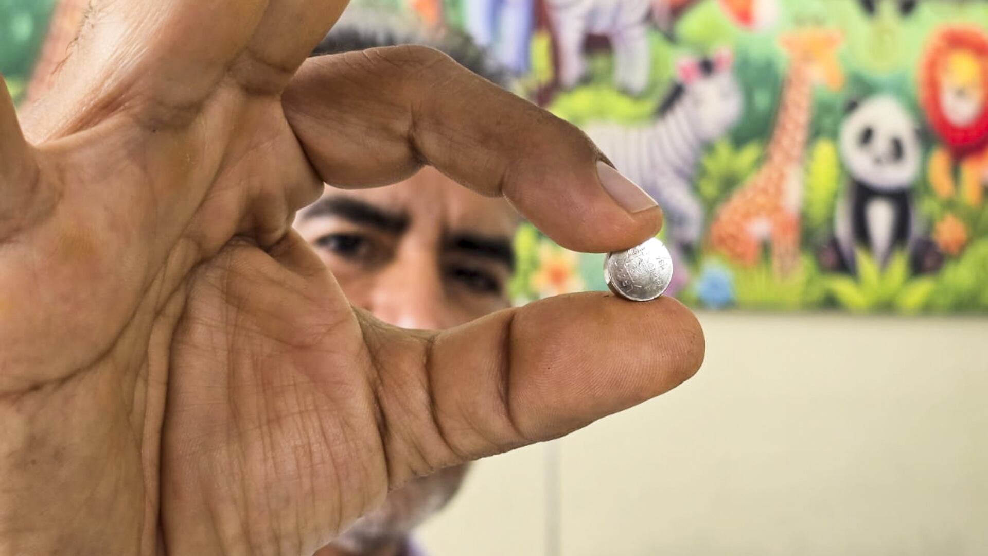 Hospital Sabogal salvó a menor tras extirparle una pila y parte del intestino delgado| EsSalud