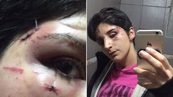 Lucía quedó muy lastimada, sobre