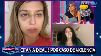 ‘Diealis’ en la mira: deberá declarar por presunta golpiza a su expareja. Captura: Magaly TV La Firme.