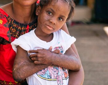 Cada año, decenas de millas