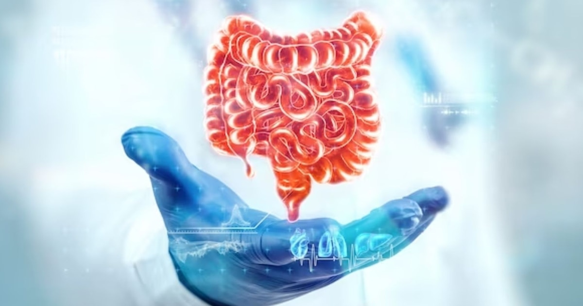 ¿Por qué aumentan los casos de cáncer colorrectal en jóvenes?: la dieta y el estilo de vida bajo la lupa