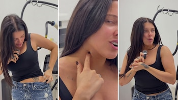 La Reini se borró los tatuajes de su “pasado tumbero”: un exnovio, una estrella de rock y un dibujo para su madre