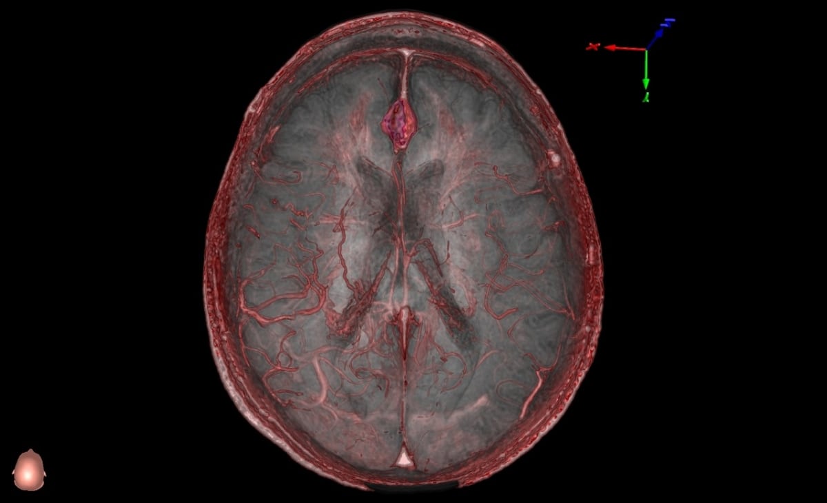 Cursos precongreso en hospitales porteños ofrecen formación avanzada en técnicas de cirugía ventricular, base de cráneo y columna vertebral
(Universidad de Stanford)