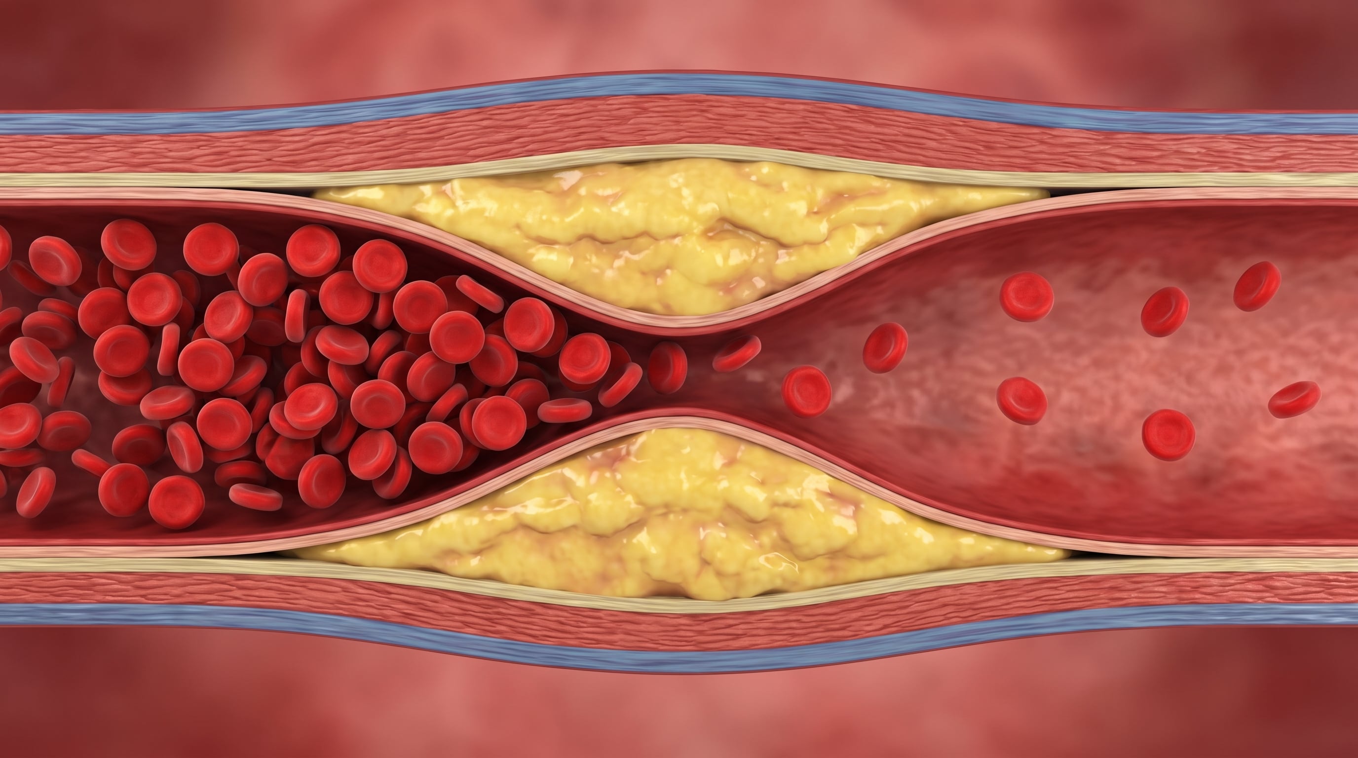 Los 6 alimentos que más pueden aumentar el colesterol, según cardiólogos y nutricionistas