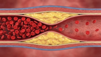 Los 6 alimentos que más pueden aumentar el colesterol, según cardiólogos y nutricionistas