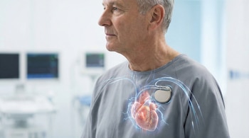 El marcapasos moderno regula el