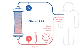 Efferon recibió la aprovación europea para distribuir un nuevo tratamiento para la sepsis en niños. (Efferon)