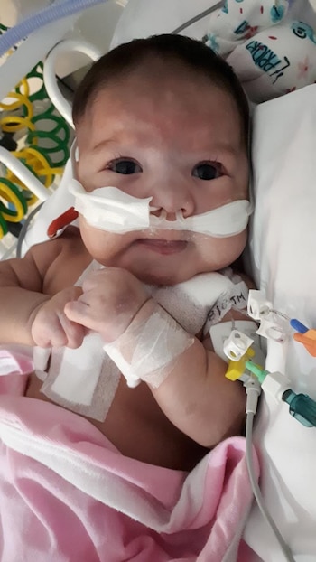 Primer plano de un bebé con tubos nasales y vendajes en las muñecas, cubierto con una manta rosa, en un entorno hospitalario