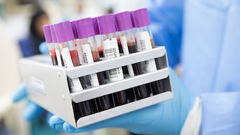 SEMEDLAB destaca el papel del laboratorio clínico en la implantación del cribado prenatal de anomalías cromosómicas