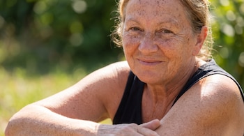 Primer plano de una mujer mayor con pecas y manchas de sol en el rostro, los hombros y los brazos.