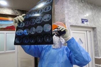 La presencia de SARS-CoV-2 fue