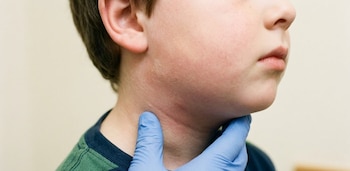 El Ministerio de Salud de El Salvador confirma 27 nuevos casos de paperas en distintas regiones durante 2026. (Visual IA)