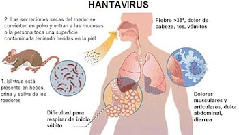 El hantavirus se transmite por inhalación de excreciones de roedores infectados, especialmente en áreas rurales y silvestres