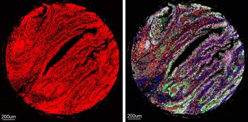 Izquierda: Las señales fluorescentes de
