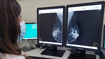 La mammographie peut fournir des