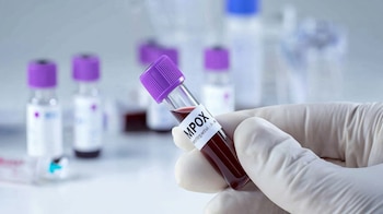 La disminución de la inmunidad