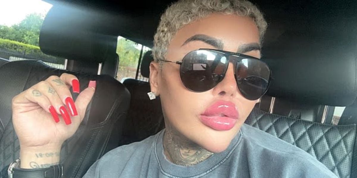 Murió Jordan James Parke, el influencer conocido como el “rey de los labios” que se quería parecer a Kim Kardashian