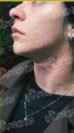 Vaquer muestra las marcas de violencia que le dejo el luchador, Cuatrero.