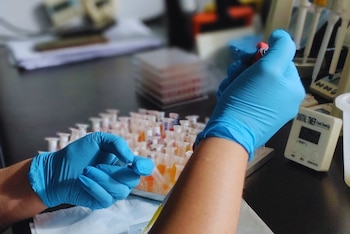 El Laboratorio de Inmunología y Parasitología del INTA Rafaela, en Santa Fe, completó un proceso de modernización destinado a fortalecer la producción de la vacuna, incorporar nuevos estándares de calidad y reforzar las condiciones de bioseguridad de uno de los desarrollos tecnológicos más relevantes para la sanidad bovina nacional.