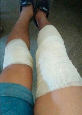 La víctima fue auxiliada por su hermana