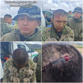 Militar herido por golpe de subteniente - crédito @SARGENTOCHALA/X