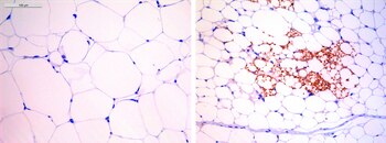 Imagen de los adipocitos de