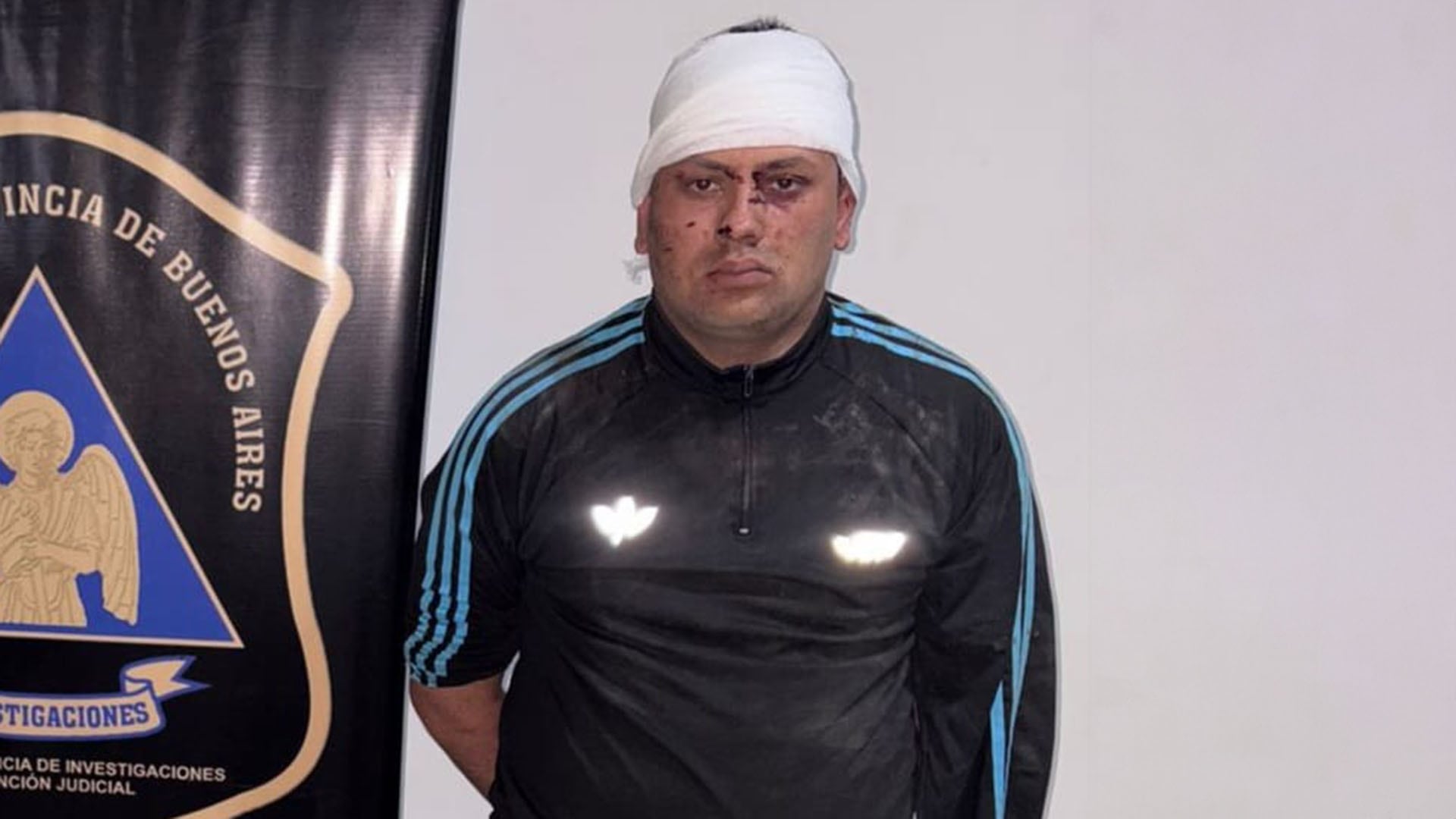 Casco con su cabeza vendada tras el arresto