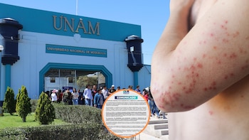 UNAM suspende clases presenciales en Moquegua por caso de sarampión y activa virtualidad, vacunación y cerco epidemiológico