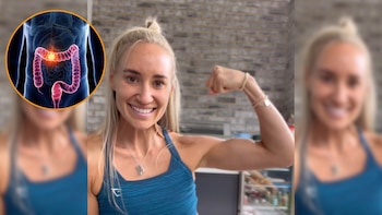 Una mujer padece un cáncer