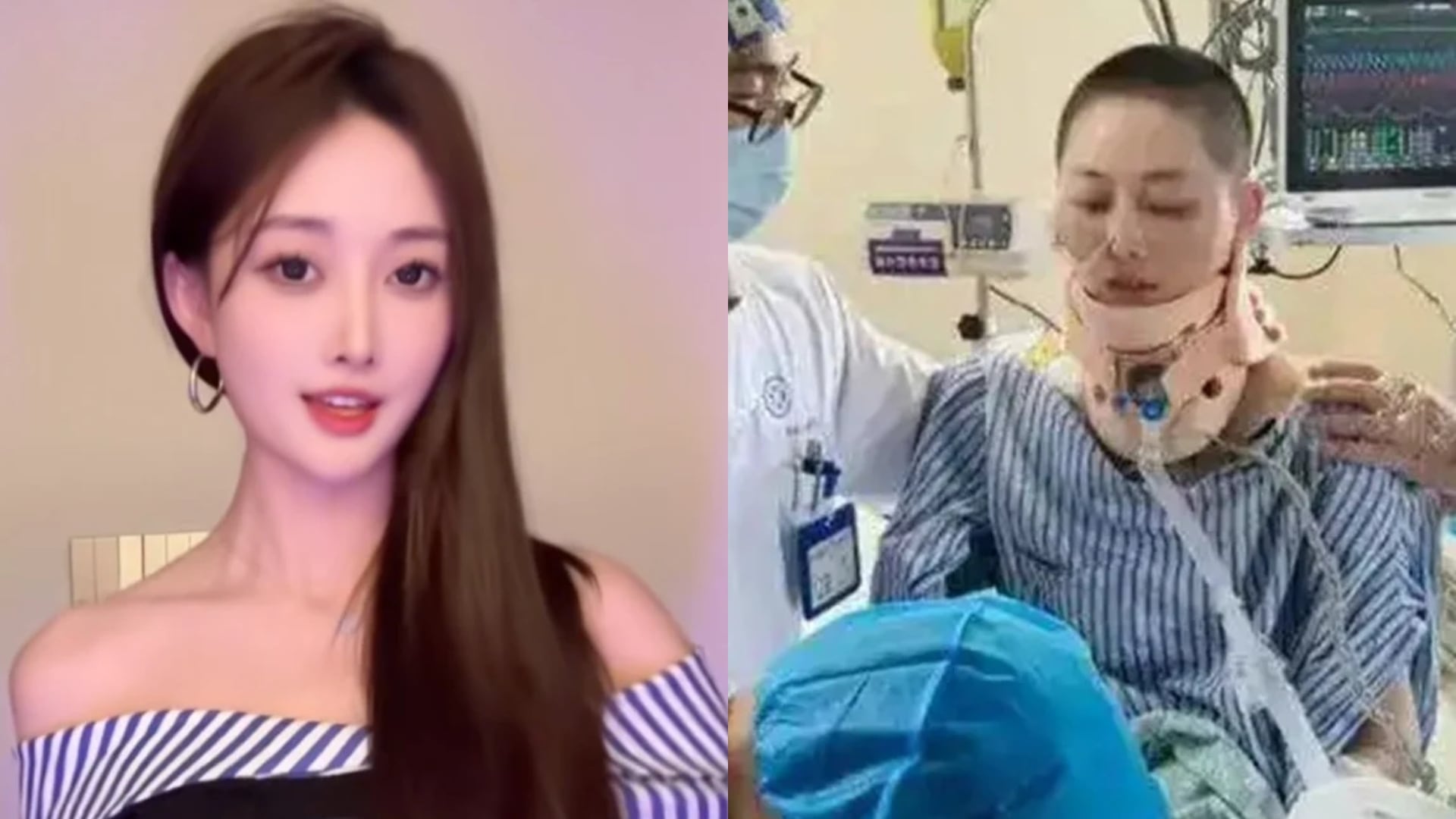 Wan Anan, la influencer china que sufrió múltiples fracturas tras caer desde el piso 35 regresa a internet: “Me siento renacida”