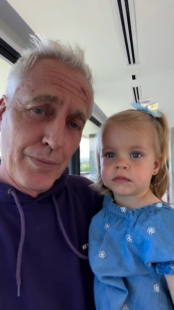 La reacción de la hija de Marley por el golpe que sufrió