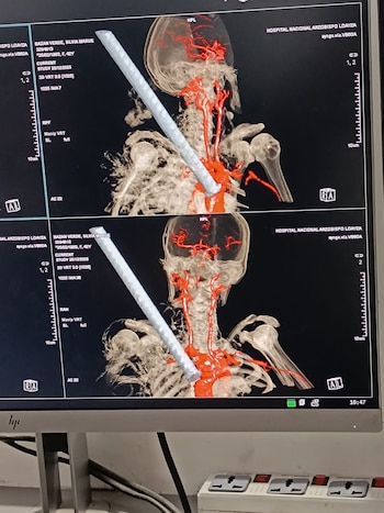 La paciente permanece estable, bajo