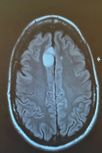 Busy Philipps reveló que fue diagnosticada con un tumor cerebral