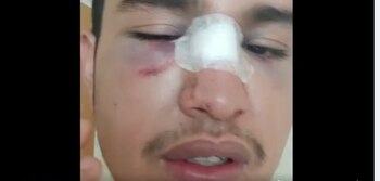 El joven golpeado presenta dificultades