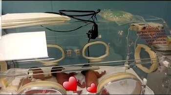 La mamá dio a luz por césarea