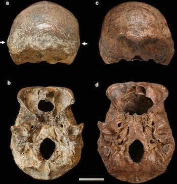 Dos cráneos humanos desde dos ángulos cada uno: vistas posteriores (a, c) e inferiores (b, d). Fondo negro. Escala de medición blanca al pie