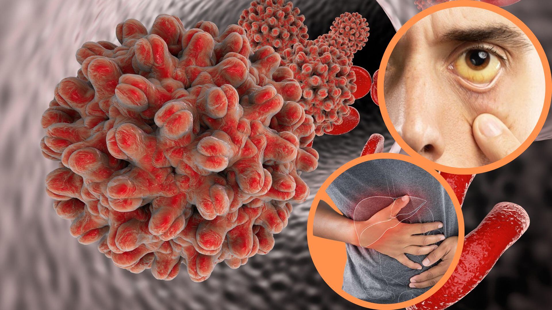 Importancia de la vacuna contra hepatitis B para prevenir cáncer de hígado