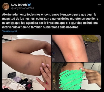 Colombianas fueron agredidas en Brasil