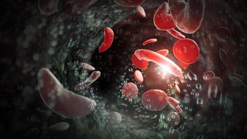 Las tasas de accidentes cerebrovasculares