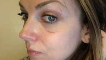 “No teníamos lo que quería