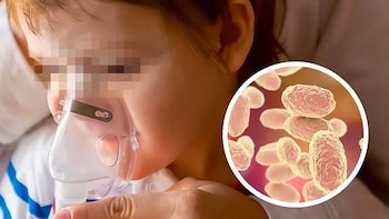 Tosferina en Honduras deja 10 muertos y más de 120 contagios en lo que va del año