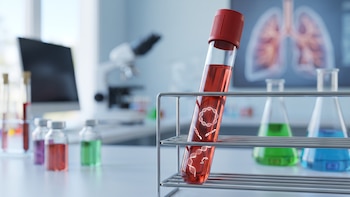 Una biopsia líquida podría anticipar casi un año la reaparición del cáncer de pulmón tras la cirugía