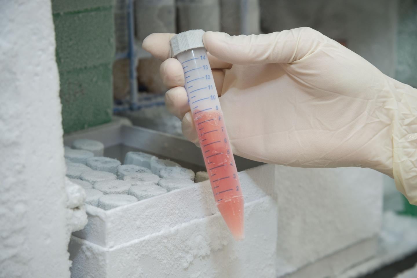 El análisis de fragmentomas y metilomas permite descubrir cambios inmunomediados y fisiológicos en distintas enfermedades humanas ( Jon Christofersen)