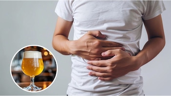 Cuál es la extraña condición